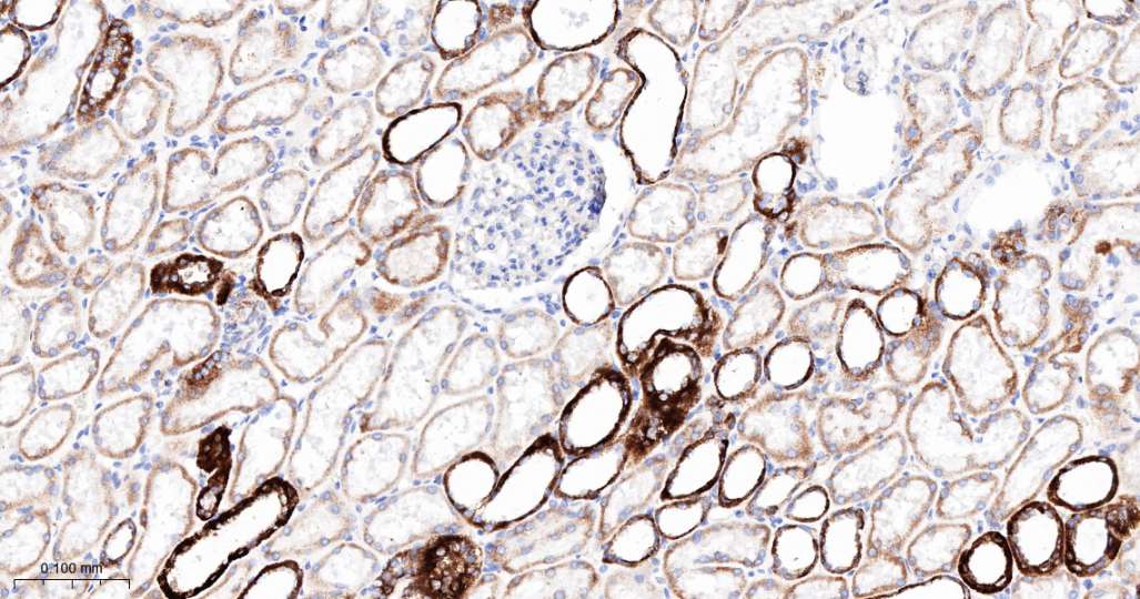 人丙酮酸脱氢酶激酶亚型2即用型免疫组化试剂盒-IHC0692H